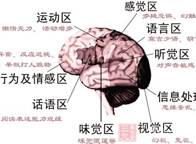 精神分裂症最新研究,精神分裂症最新研究，探索疾病本质与有效治疗策略